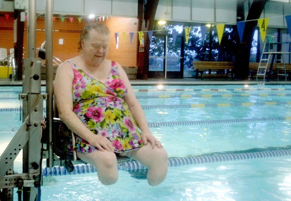 With both legs amputated to her knees