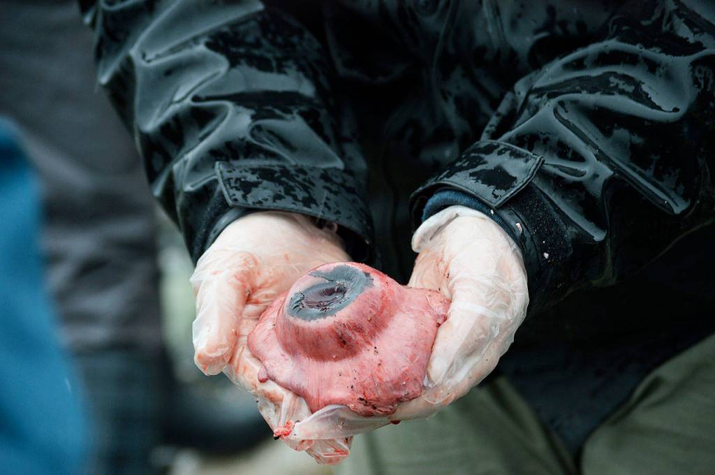 A researcher holds the whales eyeball during the necropsy. Photo by Laura Guido/Whidbey News Group
