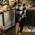 Photo by Sam Fletcher
Denise Muller attributes her rashes to coliform in her water.