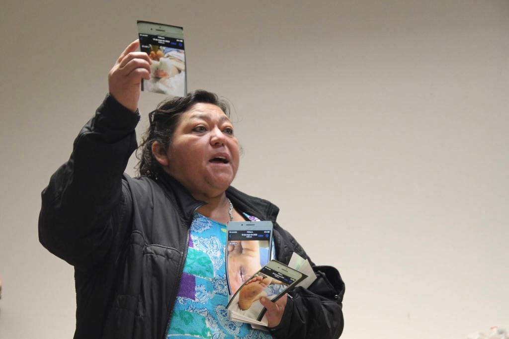 Concepción Contreras shows photos of the health affects she has suffered from the poor-quality water. (Photo by Marina Blatt)